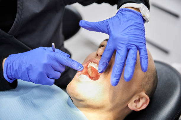 Best Cracked Tooth Emergency Dentist  in Pine Hills, CA